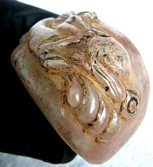 300 BC Authentic Ancient Roman hololith Ring Engraved Gemstone Depict Dolphin